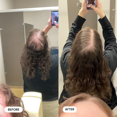 Peptide Hair Growth Serum